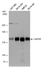 LATS1 Antibody in Western Blot (WB)