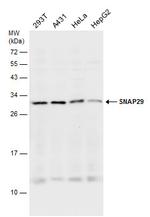 SNAP29 Antibody in Western Blot (WB)