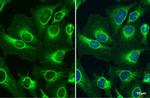 TOMM20 Antibody in Immunocytochemistry (ICC/IF)