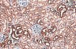 TOMM20 Antibody in Immunohistochemistry (Paraffin) (IHC (P))