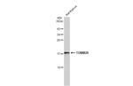 TOMM20 Antibody in Western Blot (WB)