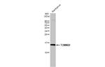 TOMM20 Antibody in Western Blot (WB)