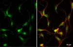 ZEB2 Antibody in Immunocytochemistry (ICC/IF)