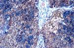 ZEB2 Antibody in Immunohistochemistry (Paraffin) (IHC (P))