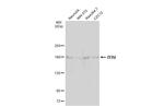 ZEB2 Antibody in Western Blot (WB)