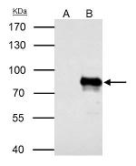 YAP1 Antibody in Immunoprecipitation (IP)