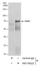 YAP1 Antibody in Immunoprecipitation (IP)