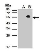 TAB1 Antibody in Western Blot (WB)