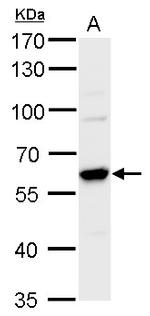 PRMT4 Antibody in Western Blot (WB)