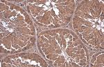 GNA13 Antibody in Immunohistochemistry (Paraffin) (IHC (P))