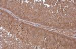 GNA13 Antibody in Immunohistochemistry (Paraffin) (IHC (P))