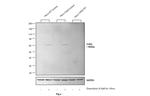 Phospho-CHK2 (Thr68) Antibody in Western Blot (WB)