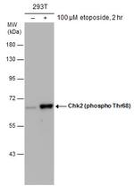 Phospho-CHK2 (Thr68) Antibody in Western Blot (WB)