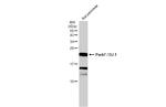 DJ-1 Antibody in Western Blot (WB)