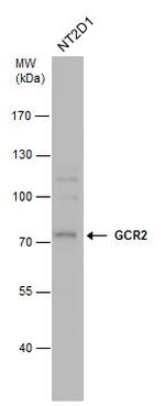 ECD Antibody in Western Blot (WB)