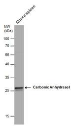 Carbonic Anhydrase I Antibody in Western Blot (WB)