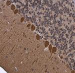 p130Cas Antibody in Immunohistochemistry (Paraffin) (IHC (P))