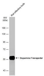 Dopamine Transporter Antibody in Western Blot (WB)