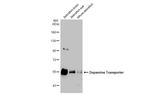 Dopamine Transporter Antibody in Western Blot (WB)