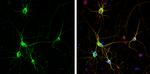 Dopamine Transporter Antibody in Immunocytochemistry (ICC/IF)