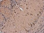 Dopamine Transporter Antibody in Immunohistochemistry (Paraffin) (IHC (P))