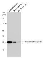 Dopamine Transporter Antibody in Western Blot (WB)