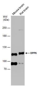 DPP6 Antibody in Western Blot (WB)