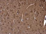 NSE Antibody in Immunohistochemistry (Paraffin) (IHC (P))