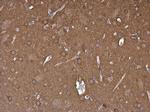 NSE Antibody in Immunohistochemistry (Paraffin) (IHC (P))