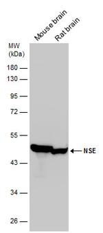 NSE Antibody in Western Blot (WB)