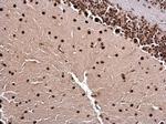 LIM1 Antibody in Immunohistochemistry (Paraffin) (IHC (P))