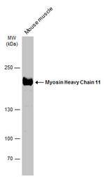 MYH11 Antibody in Western Blot (WB)