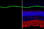 RPE65 Antibody in Immunohistochemistry (Paraffin) (IHC (P))