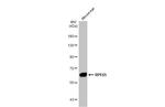 RPE65 Antibody in Western Blot (WB)