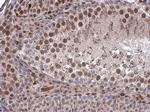 Brachyury Antibody in Immunohistochemistry (Paraffin) (IHC (P))