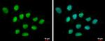 DIS3 Antibody in Immunocytochemistry (ICC/IF)