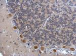 DIS3 Antibody in Immunohistochemistry (Paraffin) (IHC (P))