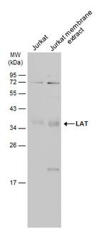 LAT Antibody in Western Blot (WB)