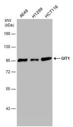 GIT1 Antibody in Western Blot (WB)