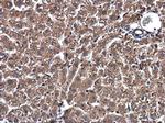 SSU72 Antibody in Immunohistochemistry (Paraffin) (IHC (P))