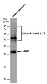 SSU72 Antibody in Western Blot (WB)