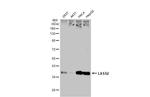 Lass2 Antibody in Western Blot (WB)