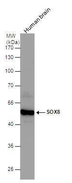 SOX8 Antibody in Western Blot (WB)