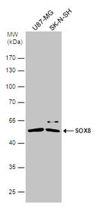 SOX8 Antibody in Western Blot (WB)