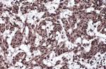 TIF1 gamma Antibody in Immunohistochemistry (Paraffin) (IHC (P))