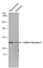 GABBR1 Antibody in Western Blot (WB)