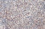 PARP14 Antibody in Immunohistochemistry (Paraffin) (IHC (P))