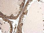 TSG Antibody in Immunohistochemistry (Paraffin) (IHC (P))