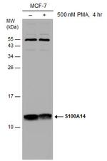 S100A14 Antibody in Western Blot (WB)