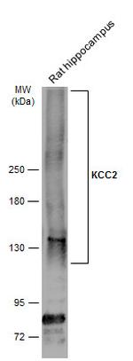 KCC2 Antibody in Western Blot (WB)